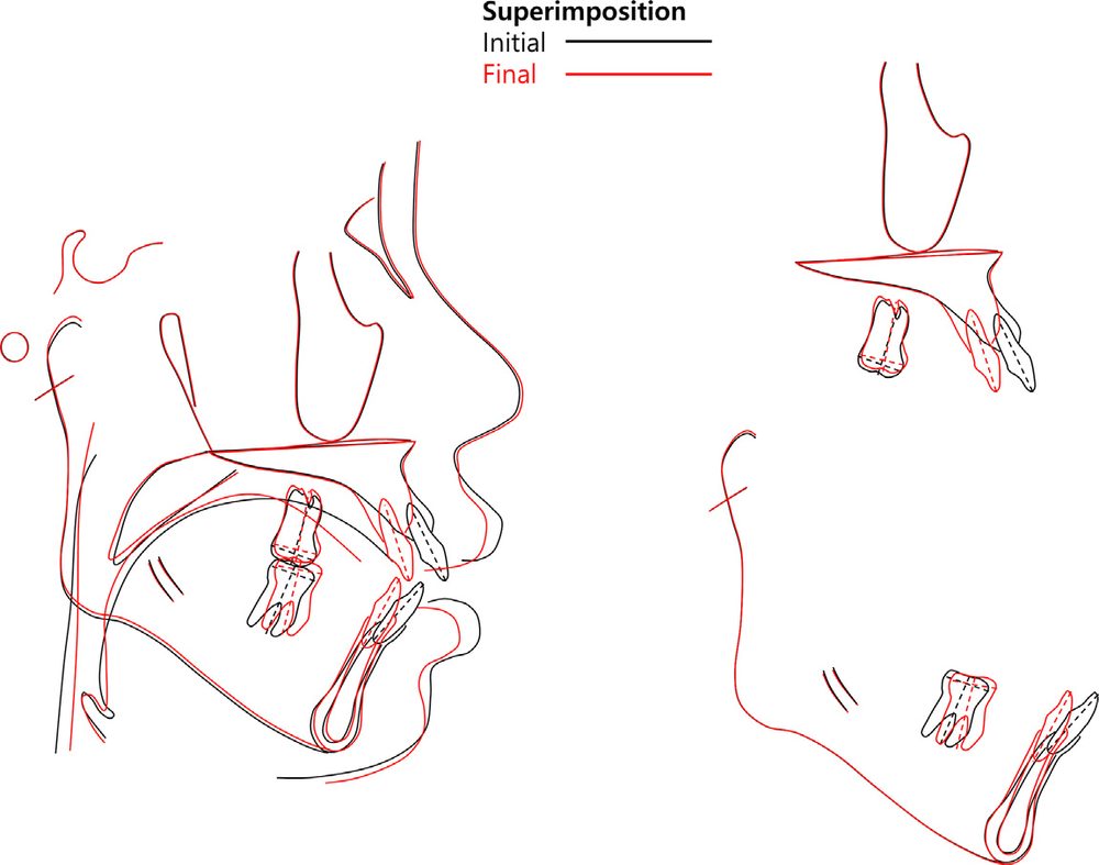 Figure 14